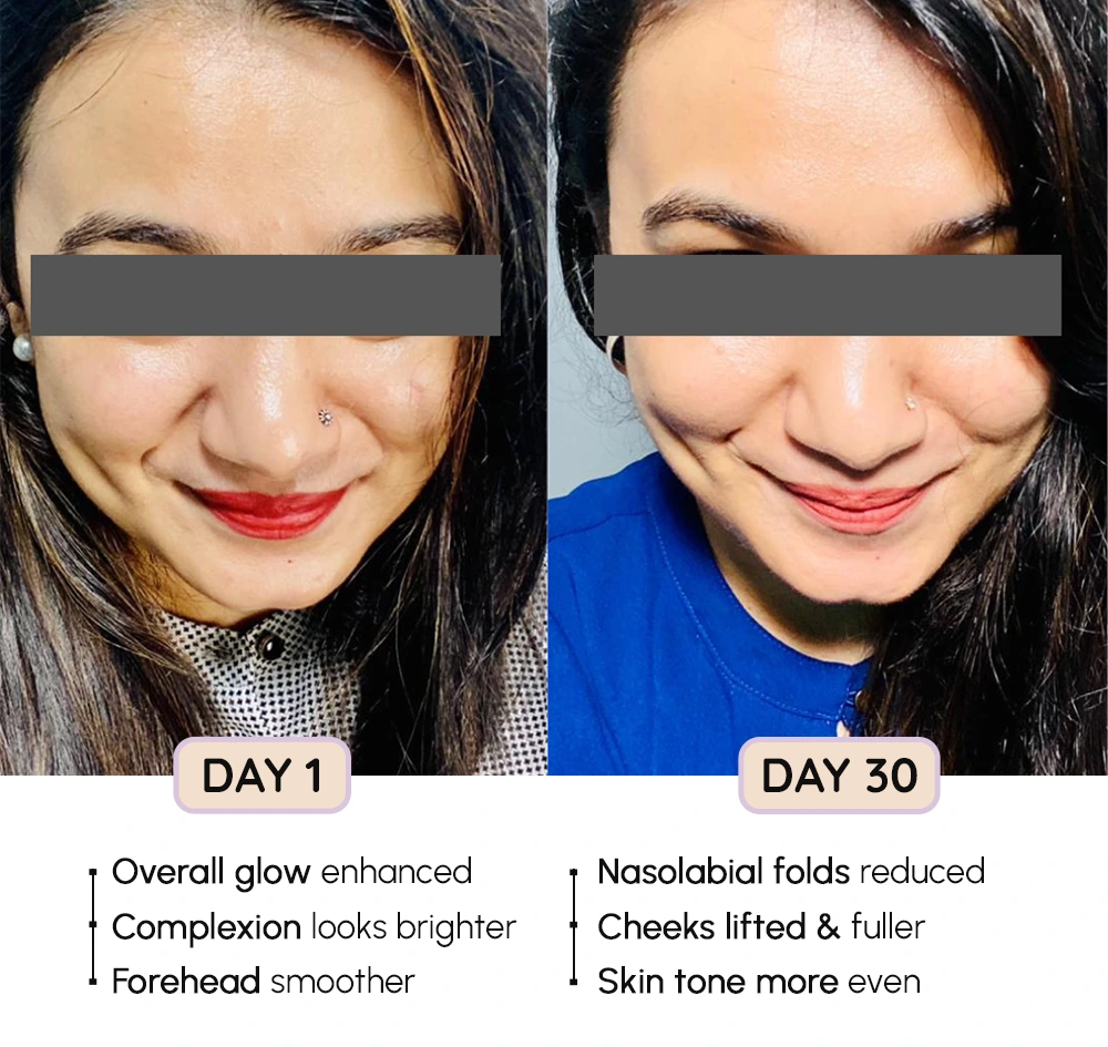 FaceEvolve Before-After 1