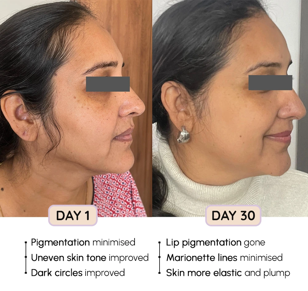 FaceEvolve Before-After 2