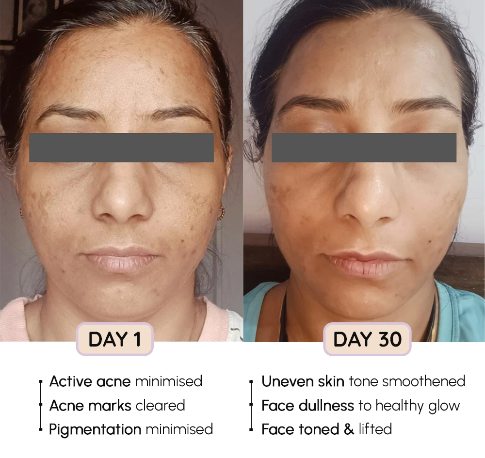 FaceEvolve Before-After 3