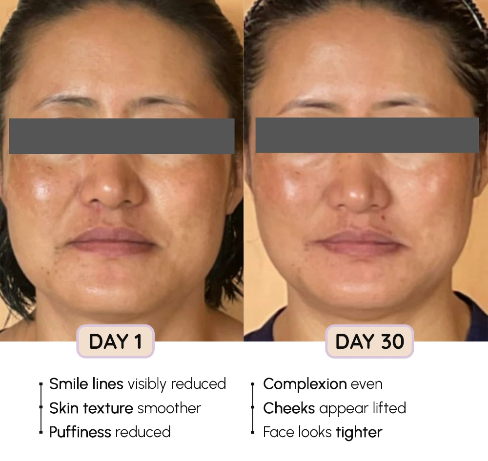 FaceEvolve Before-After 4