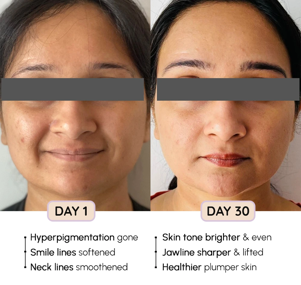 FaceEvolve Before-After 5